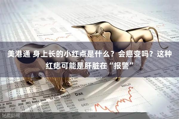 美港通 身上长的小红点是什么？会癌变吗？这种红痣可能是肝脏在“报警”